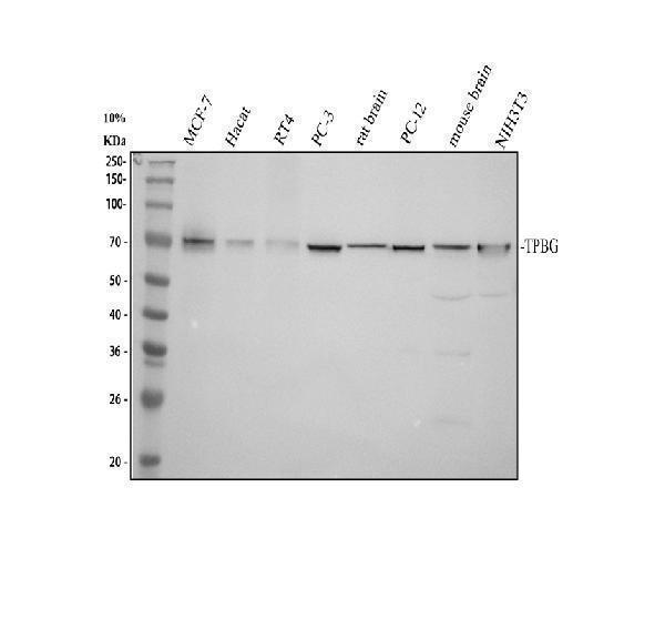 Western blot analysis of TPBG using anti-TPBG antibody (A07442-1)