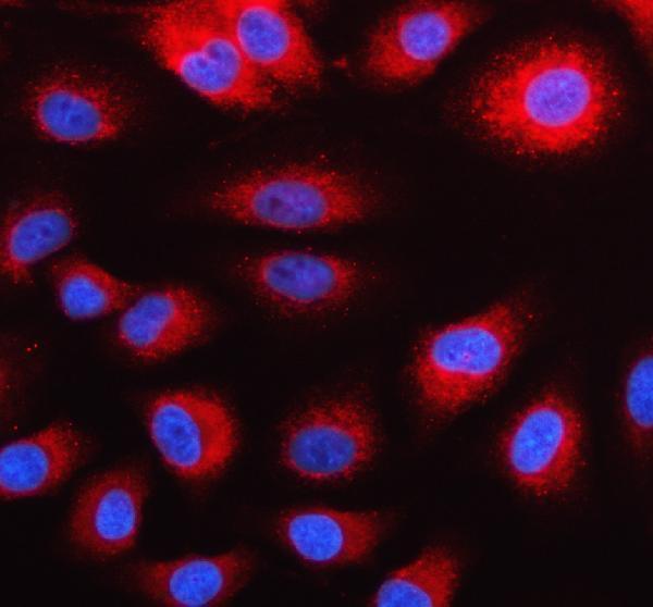IF analysis of GDI2 using anti-GDI2 antibody (A07443-2)