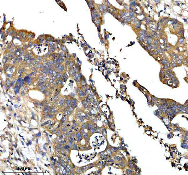 IHC analysis of GDI2 using anti-GDI2 antibody (A07443-2)