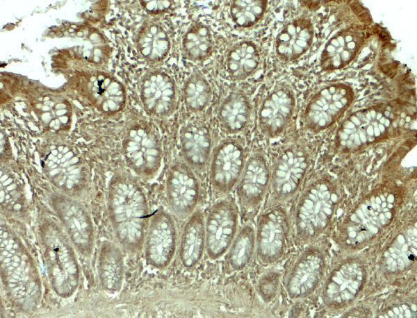 a07445 wsb1 primary antibodies ihc testing 2