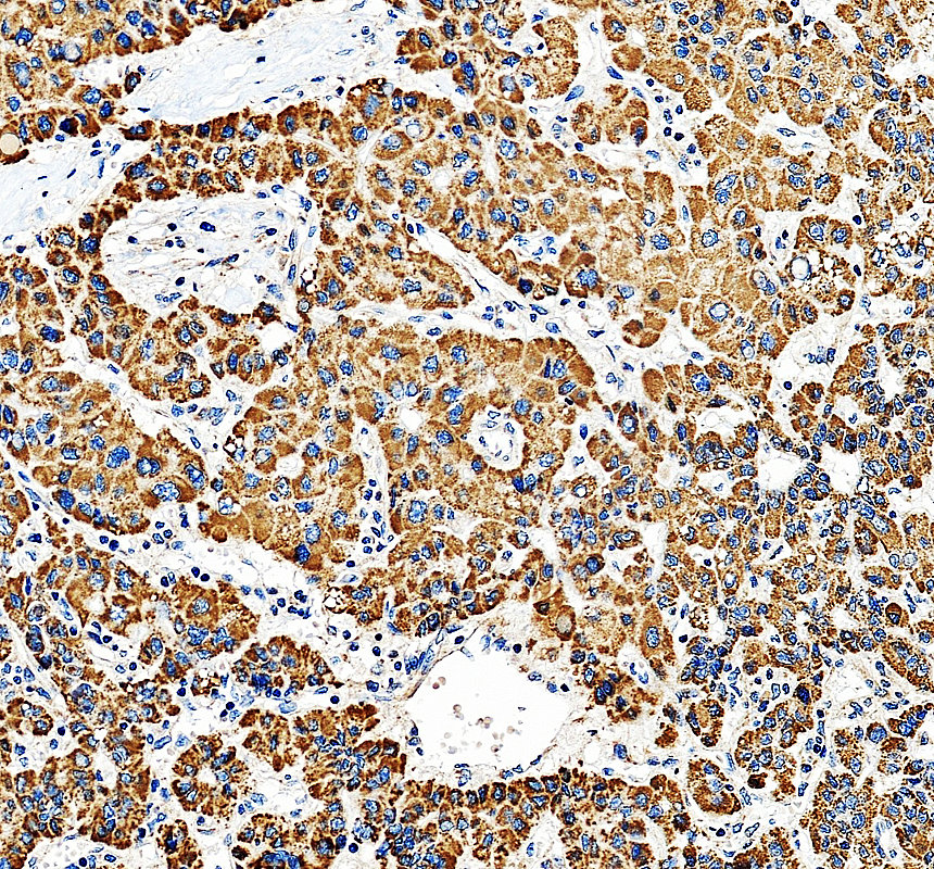 IHC analysis of JTB using anti-JTB antibody (A07448-2)