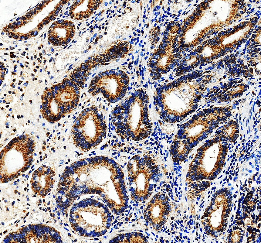 IHC analysis of JTB using anti-JTB antibody (A07448-2)