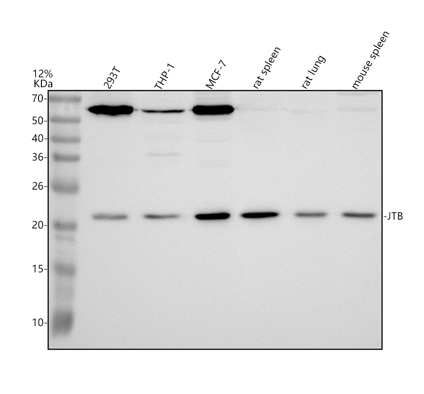 Western blot analysis of JTB using anti-JTB antibody (A07448-2)