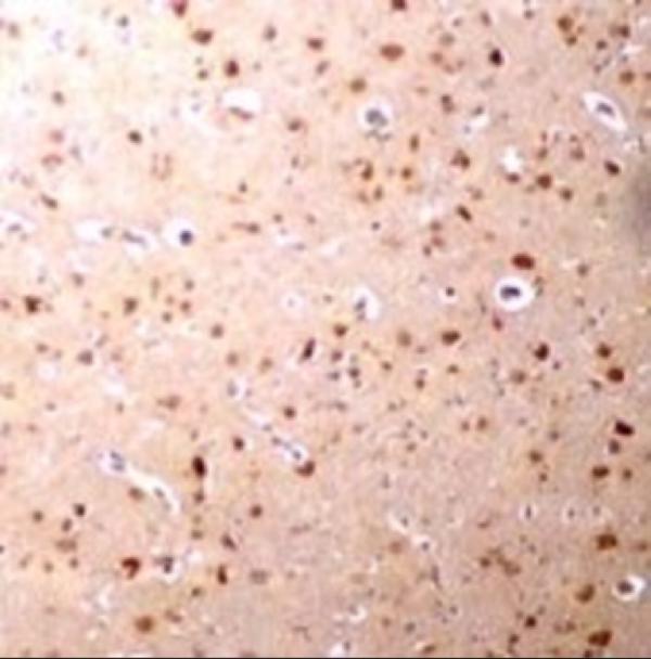 Immunohistochemistry of Nanos3 in human brain tissue with Nanos3 antibody at 2