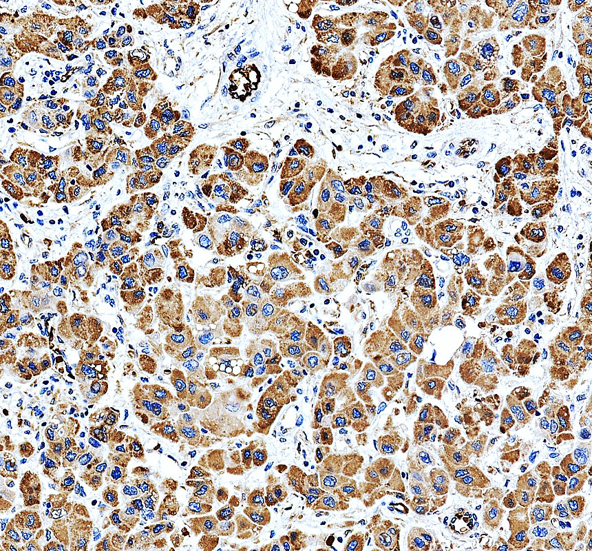 a07452 1 mtpn primary antibodies ihc testing 1