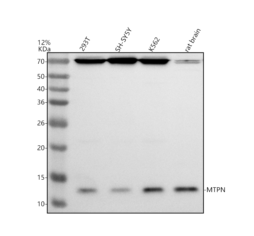 a07452 1 mtpn primary antibodies wb testing 1