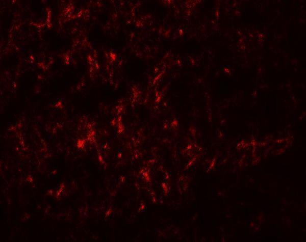 Immunofluorescence of SLC29A4 in human brain tissue with SLC29A4 antibody at 20 μg/mL