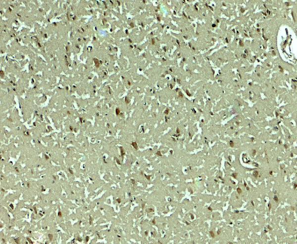 Immunohistochemistry of SLC29A4 in human brain tissue with SLC29A4 antibody at 5 μg/mL