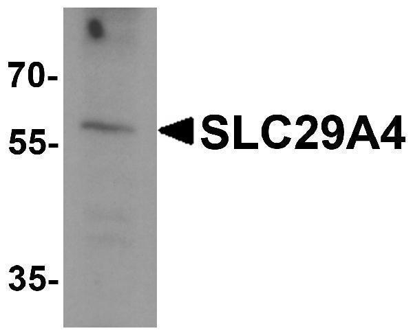 Western blot analysis of SLC29A4 in SK-N-SH cell lysate with SLC29A4 antibody at 1 μg/ml