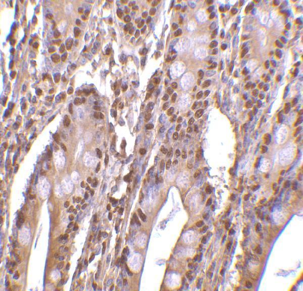 Immunohistochemistry of PHAP III in human small intestine tissue with PHAP III antibody at 2 μg/mL