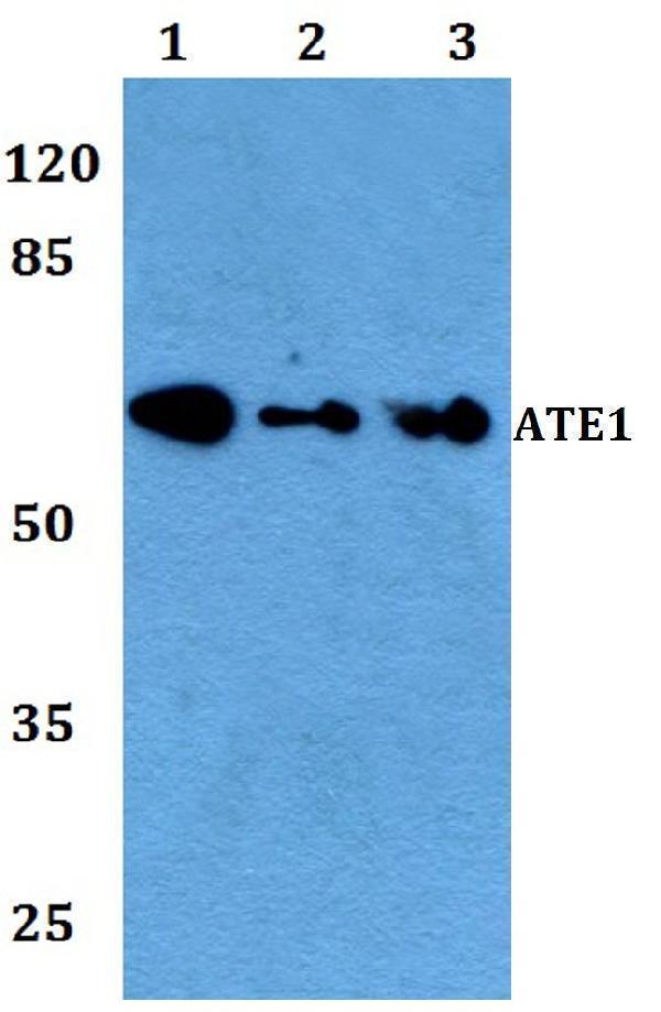 a07459 ate1 primary antiboties wb testing 1