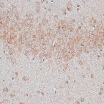 a07462 tmx1 primary antiboties ihc testing 2