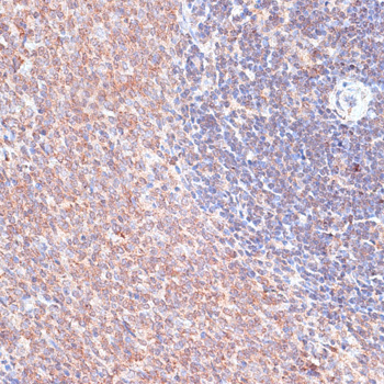 a07462 tmx1 primary antiboties ihc testing 3