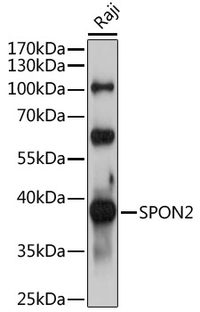 a07465 spon2 primary antiboties wb testing 1