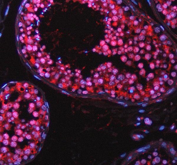 a07466 1 taok2 primary antibodies if testing 1
