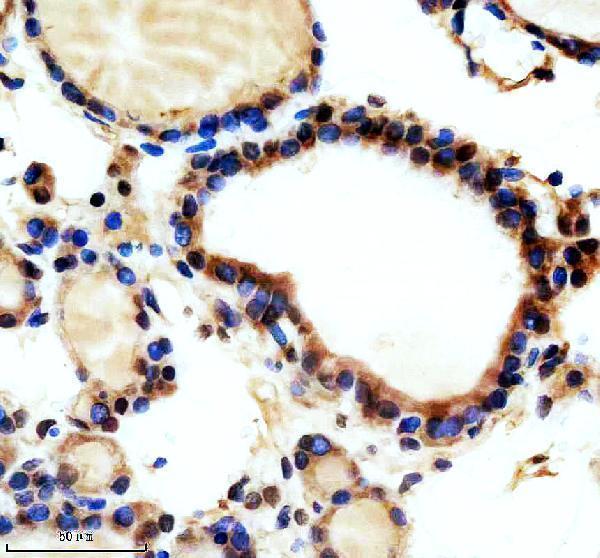 IHC analysis of TAOK2 using anti-TAOK2 antibody (A07466-1)