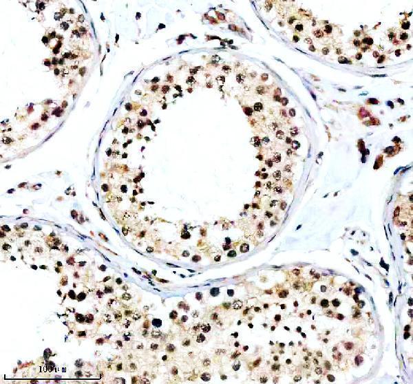 IHC analysis of TAOK2 using anti-TAOK2 antibody (A07466-1)