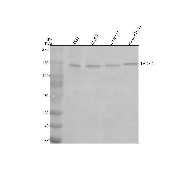 Western blot analysis of TAOK2 using anti-TAOK2 antibody (A07466-1)