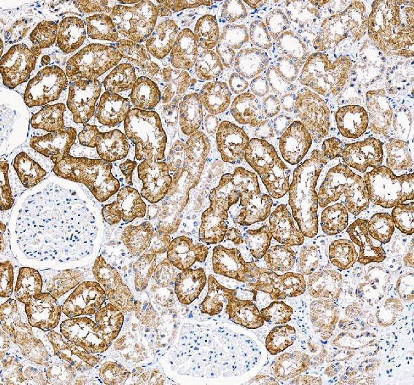 IHC analysis of SLC26A1 using anti-SLC26A1 antibody (A07470-1)