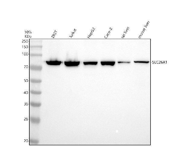 Western blot analysis of SLC26A1 using anti-SLC26A1 antibody (A07470-1)