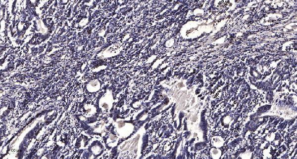 a07471 1 lpcat2 primary antibodies ihc testing 1