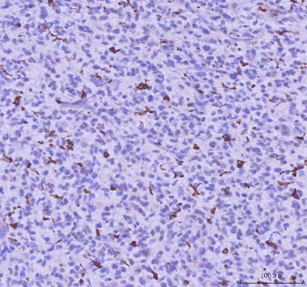  IHC analysis of LPCAT2 using anti-LPCAT2 antibody (A07471-2)
