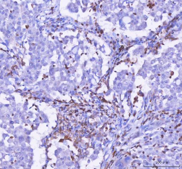  IHC analysis of LPCAT2 using anti-LPCAT2 antibody (A07471-2)