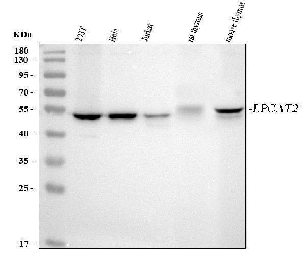  Western blot analysis of LPCAT2 using anti-LPCAT2 antibody (A07471-2)