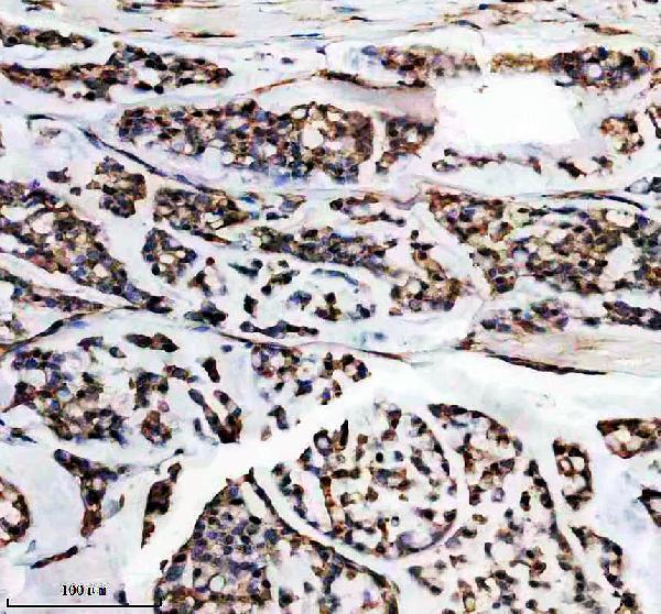 a07472 1 dmtf1 primary antibodies ihc testing 3