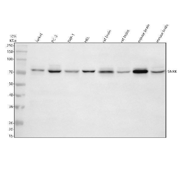 Western blot analysis of SNRK using anti-SNRK antibody (A07476-1)