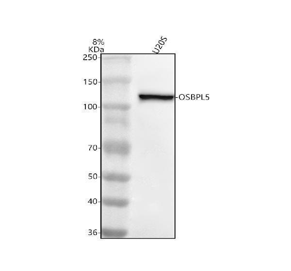  Western blot analysis of OSBPL5 using anti-OSBPL5 antibody (A07477-1)