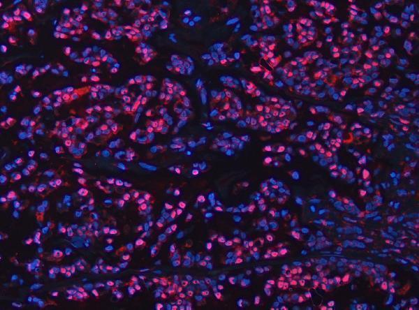 a07478 1 ube2m primary antibodies if testing 8