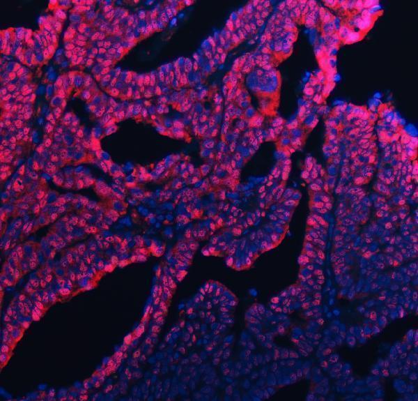 a07478 1 ube2m primary antibodies if testing 9