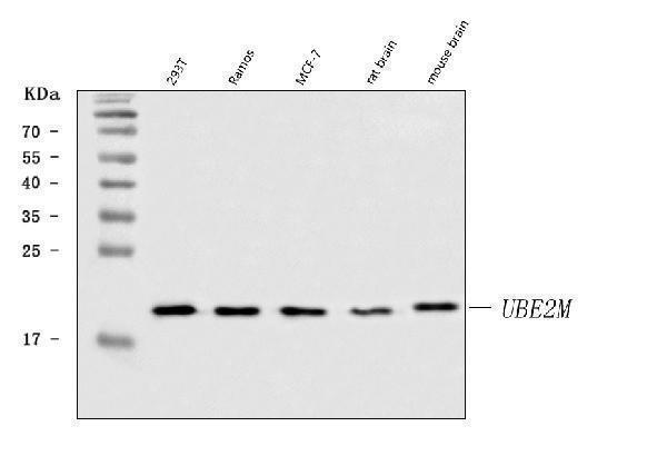  Western blot analysis of UBC12/UBE2M using anti-UBC12/UBE2M antibody (A07478-1)