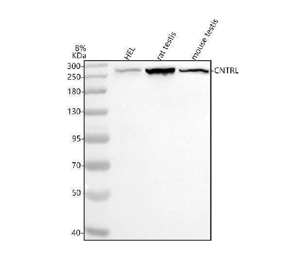  Western blot analysis of CEP110/CNTRL using anti-CEP110/CNTRL antibody (A07479-1)