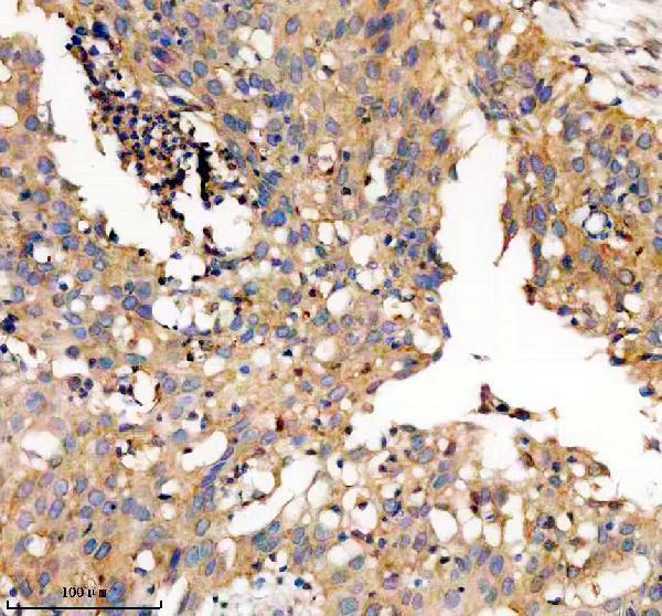 IHC analysis of TWSG1 using anti-TWSG1 antibody (A07489)