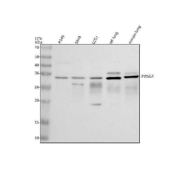 Western blot analysis of TWSG1 using anti-TWSG1 antibody (A07489)