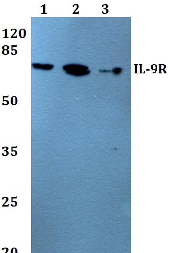 Western blot (WB) analysis of IL-9R (L514) polyclonal antibody at 1:500 dilution
Lane1:HEK293T whole cell lysate
Lane2:A549 whole cell lysate
Lane3:H9C2 whole cell lysate