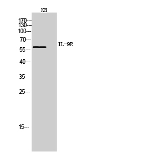 Western Blot (WB) analysis of KB cells using IL-9R Polyclonal antibody