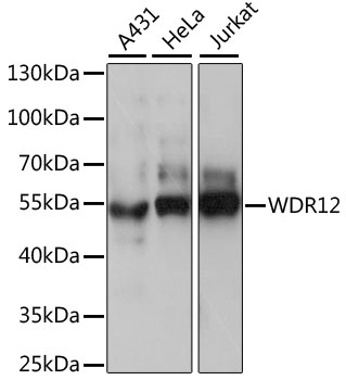 a07492 wdr12 primary antiboties wb testing 1