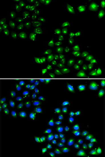 a07493 copb2 primary antiboties ihc testing 2