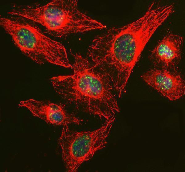 a07494 1 rbm25 primary antibodies if testing 4