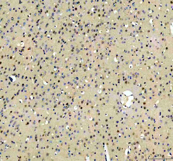  IHC analysis of RBM25 using anti-RBM25 antibody (A07494-1)