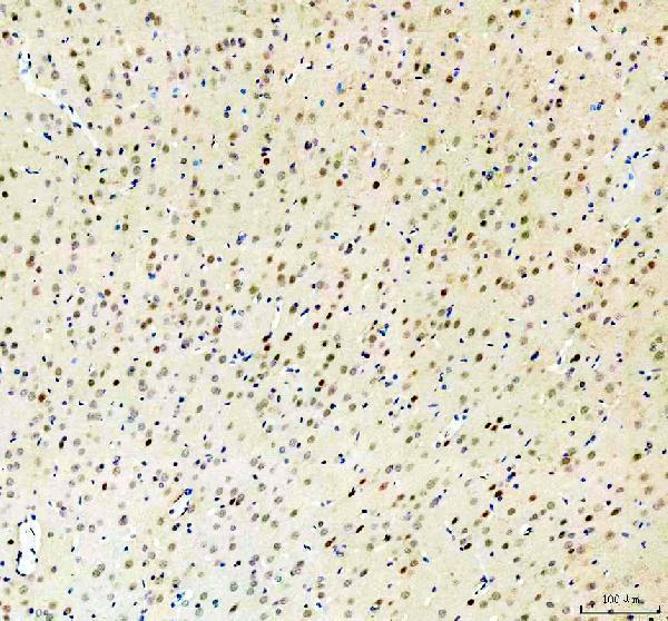 a07494 1 rbm25 primary antibodies ihc testing 3_1