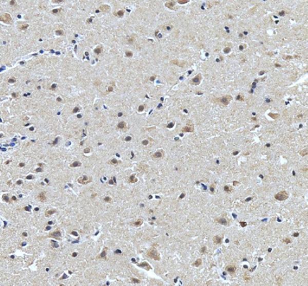 IHC analysis of RBM25 using anti-RBM25 antibody (A07494-1)
