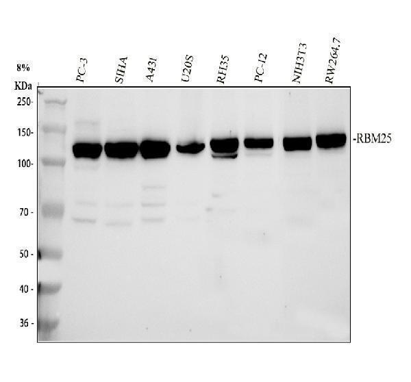  Western blot analysis of RBM25 using anti-RBM25 antibody (A07494-1)