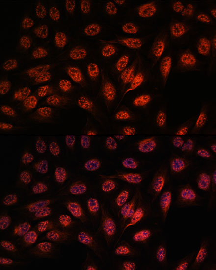 Immunofluorescence analysis of U-2 OS cells using RBM25 antibody  at dilution of 1:100