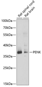 a07495 1 penk primary antiboties wb testing 1