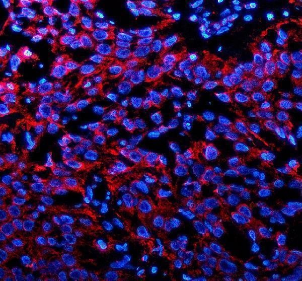 IF analysis of P2RX1 using anti-P2RX1 antibody (A07497-2)