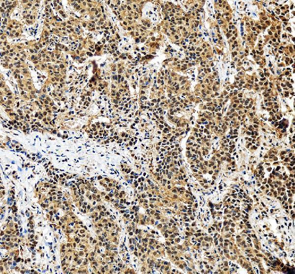 IHC analysis of PSMA5 using anti-PSMA5 antibody (A07499-1)